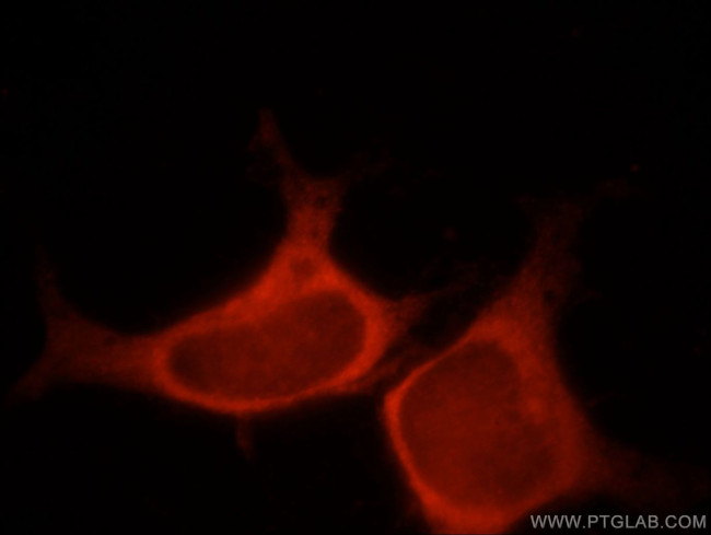 SPATA13 Antibody in Immunocytochemistry (ICC/IF)