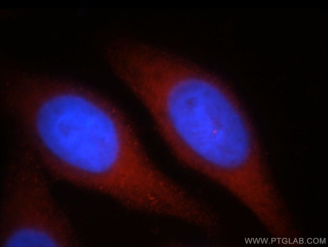 SPATA13 Antibody in Immunocytochemistry (ICC/IF)