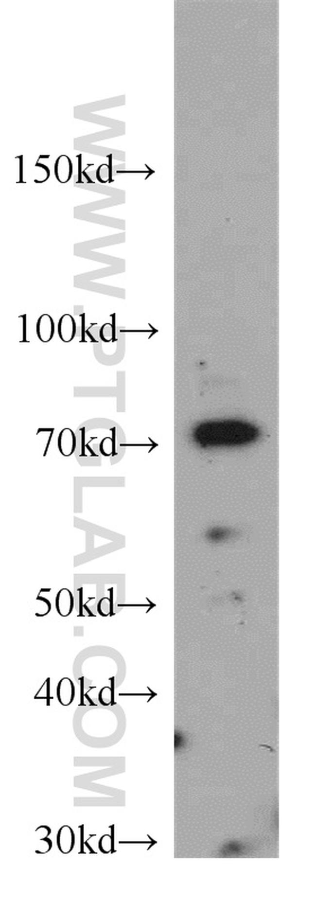 SPATA13 Antibody in Western Blot (WB)