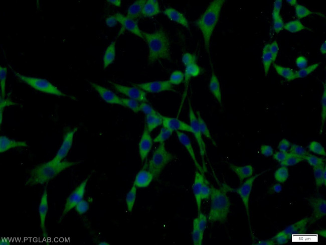 PAK1 Antibody in Immunocytochemistry (ICC/IF)