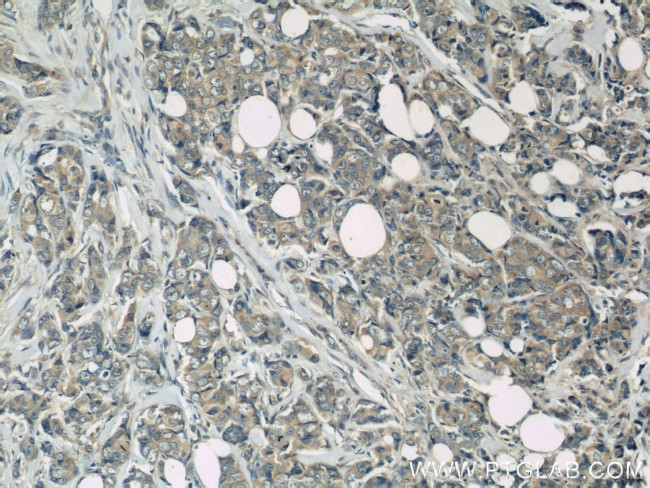 PAK1 Antibody in Immunohistochemistry (Paraffin) (IHC (P))