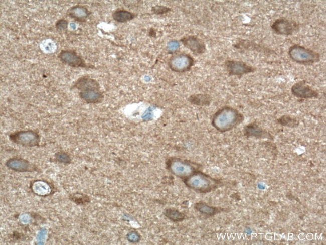 PAK1 Antibody in Immunohistochemistry (Paraffin) (IHC (P))