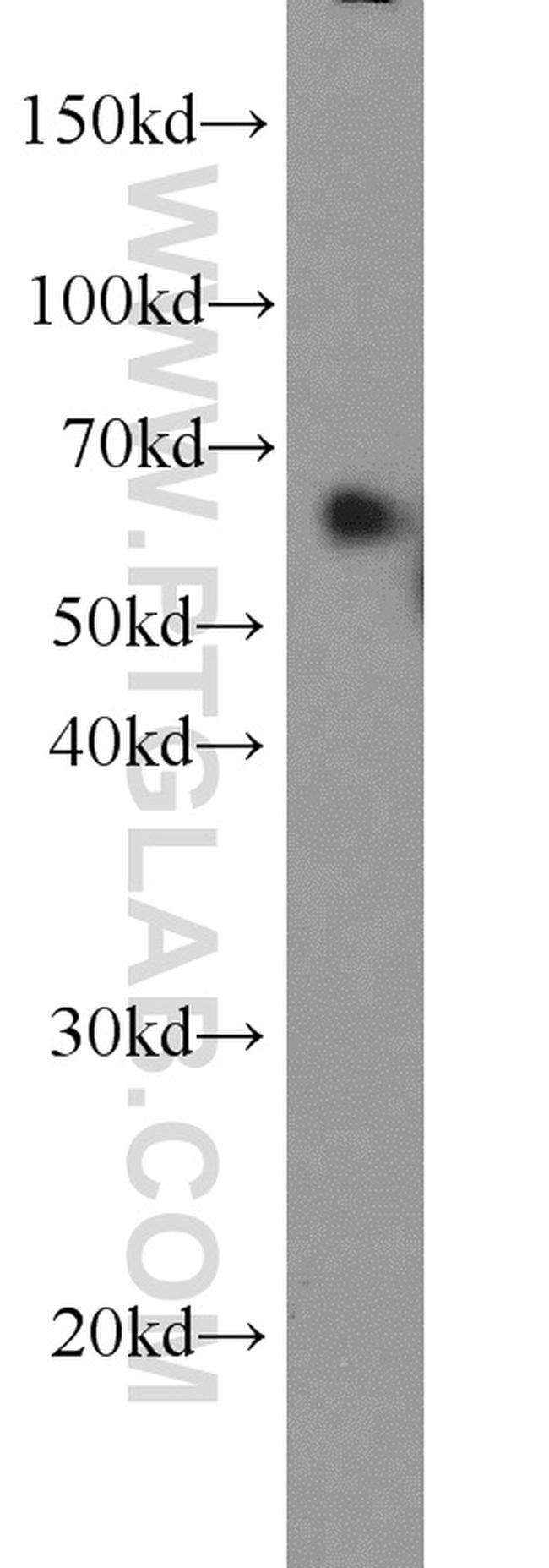 PAK1 Antibody in Western Blot (WB)