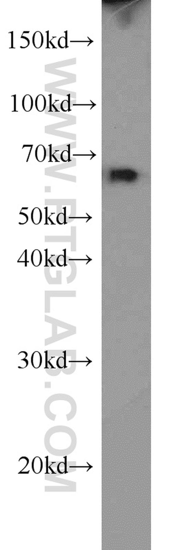 PAK1 Antibody in Western Blot (WB)