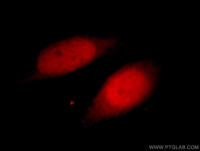 UHRF1 Antibody in Immunocytochemistry (ICC/IF)