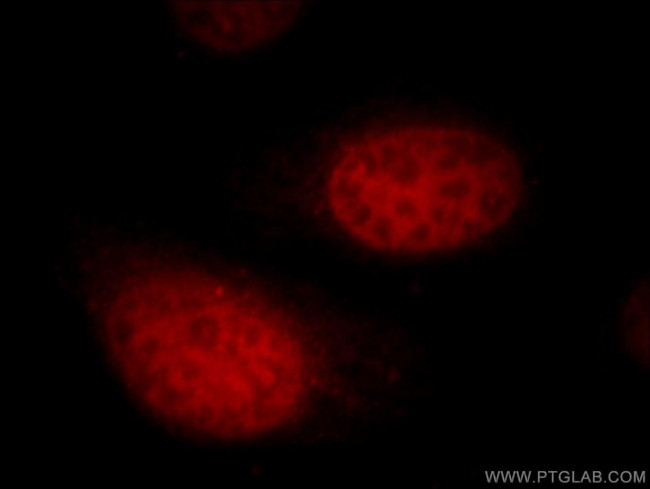 UHRF1 Antibody in Immunocytochemistry (ICC/IF)