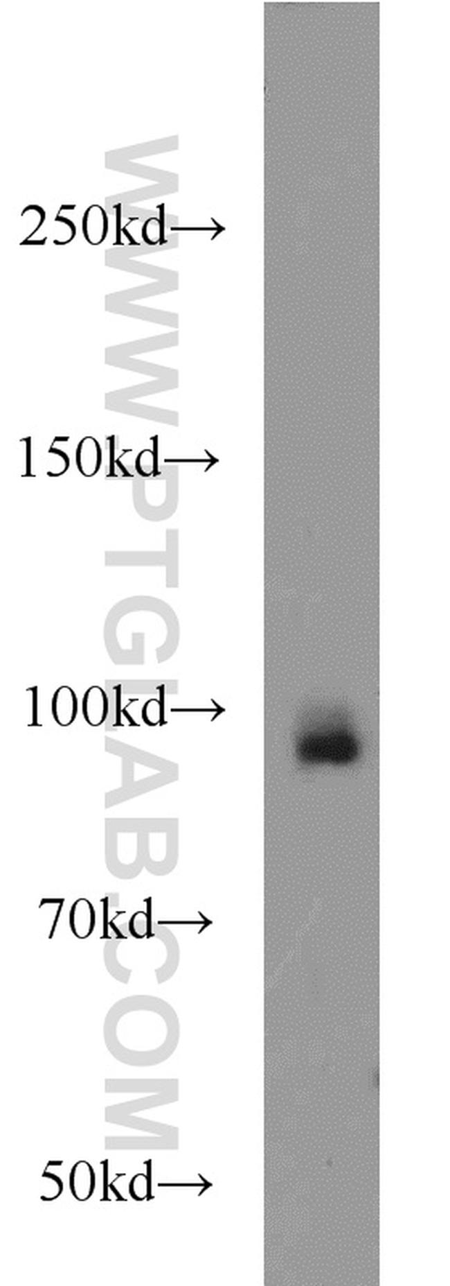 UHRF1 Antibody in Western Blot (WB)