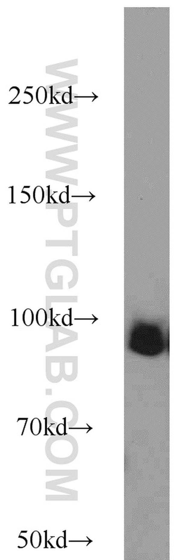 UHRF1 Antibody in Western Blot (WB)