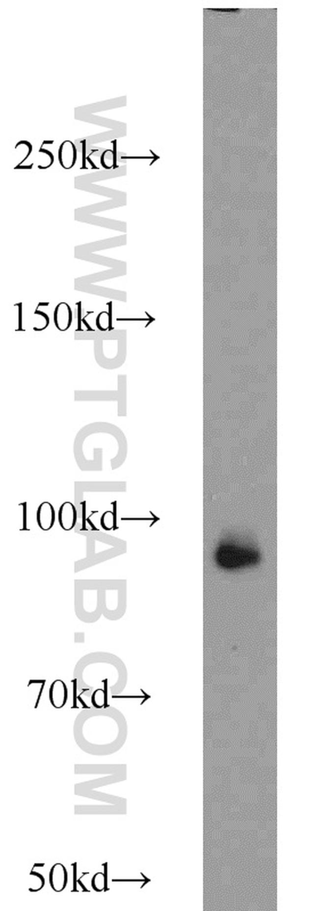 UHRF1 Antibody in Western Blot (WB)