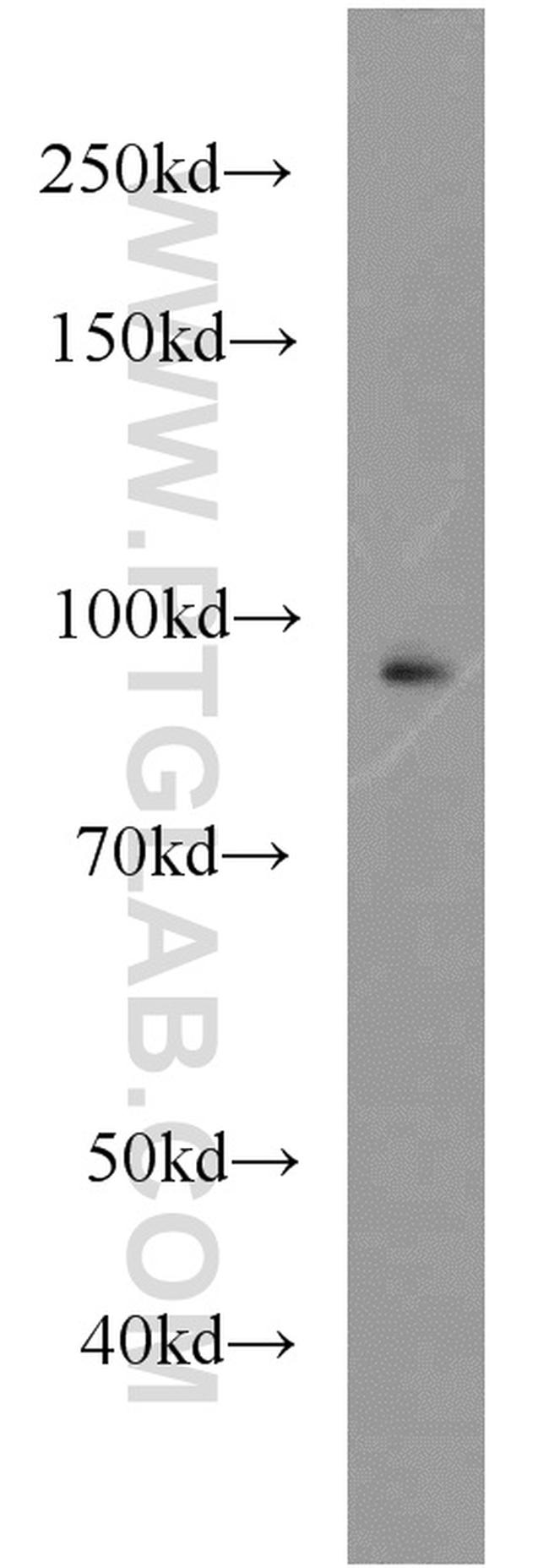 UHRF1 Antibody in Western Blot (WB)