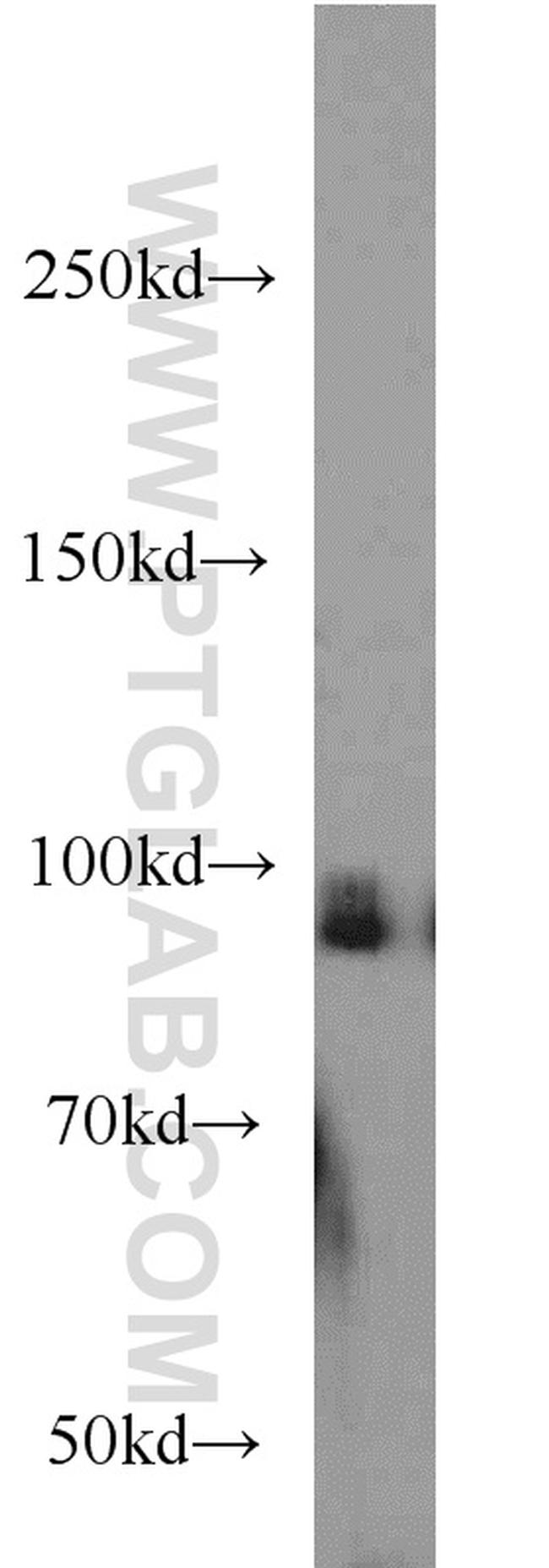 UHRF1 Antibody in Western Blot (WB)