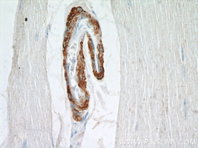 SMMHC Antibody in Immunohistochemistry (Paraffin) (IHC (P))