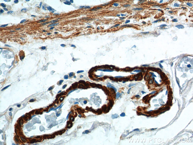 SMMHC Antibody in Immunohistochemistry (Paraffin) (IHC (P))