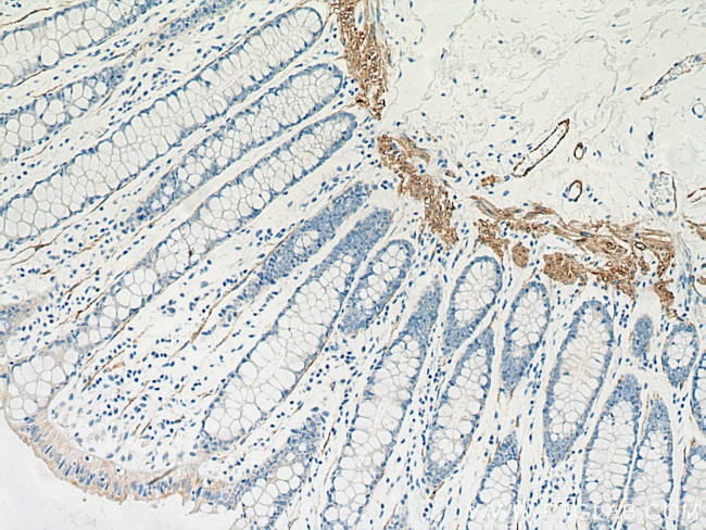 SMMHC Antibody in Immunohistochemistry (Paraffin) (IHC (P))