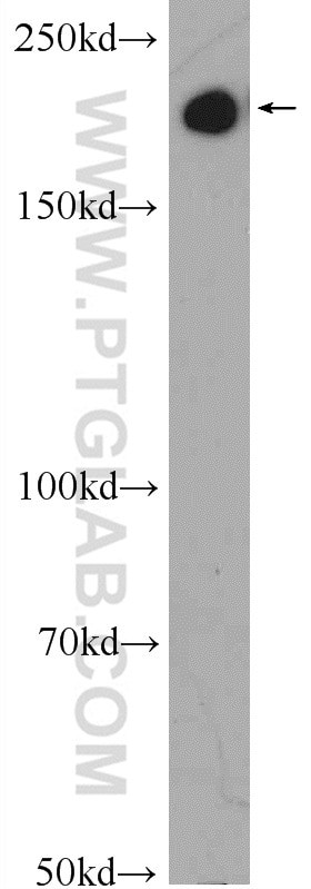 SMMHC Antibody in Western Blot (WB)