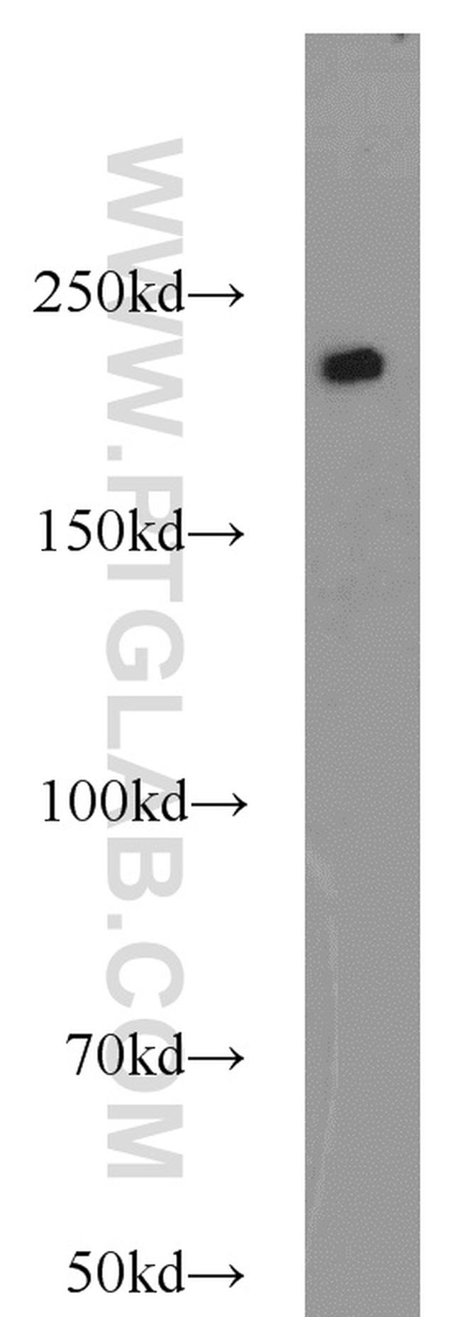 SMMHC Antibody in Western Blot (WB)