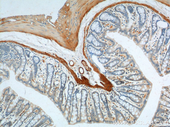 SMMHC Antibody in Immunohistochemistry (Paraffin) (IHC (P))