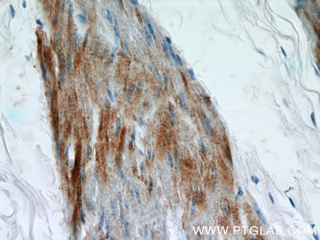 SMMHC Antibody in Immunohistochemistry (Paraffin) (IHC (P))