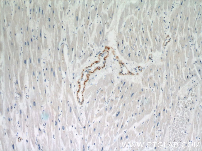 SMMHC Antibody in Immunohistochemistry (Paraffin) (IHC (P))