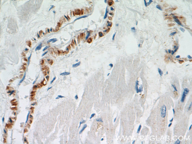 SMMHC Antibody in Immunohistochemistry (Paraffin) (IHC (P))