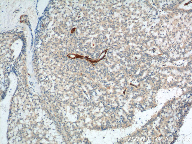 SMMHC Antibody in Immunohistochemistry (Paraffin) (IHC (P))