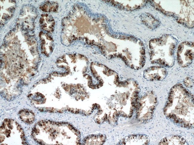 PLA2G4F Antibody in Immunohistochemistry (Paraffin) (IHC (P))