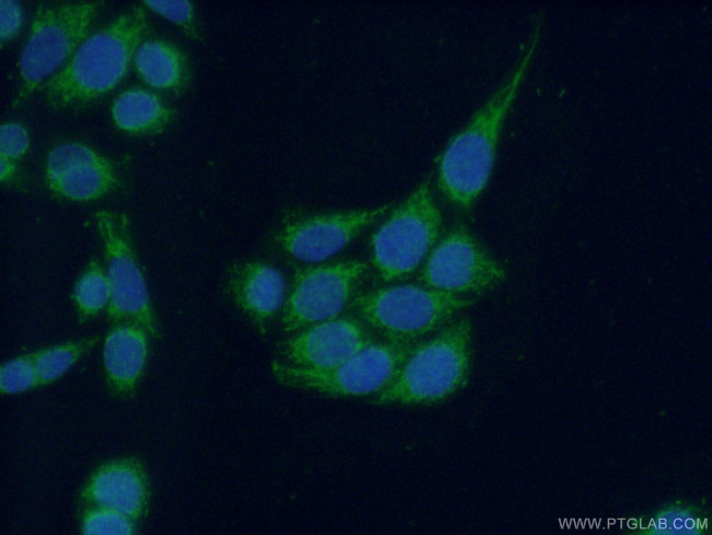 INPP5J Antibody in Immunocytochemistry (ICC/IF)