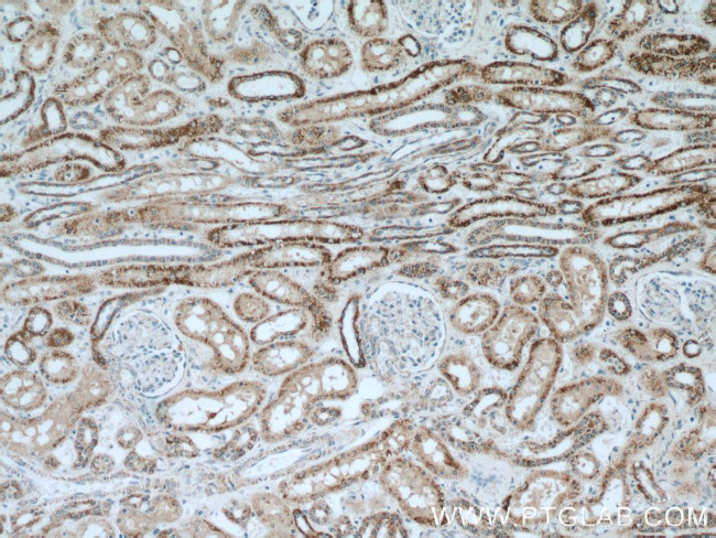 INPP5J Antibody in Immunohistochemistry (Paraffin) (IHC (P))