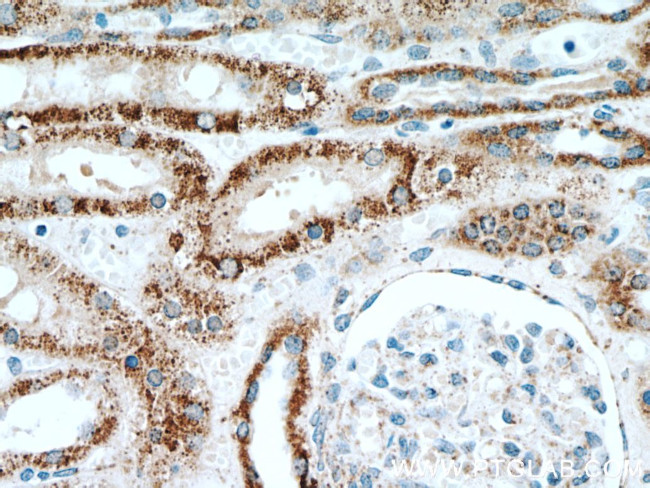 INPP5J Antibody in Immunohistochemistry (Paraffin) (IHC (P))