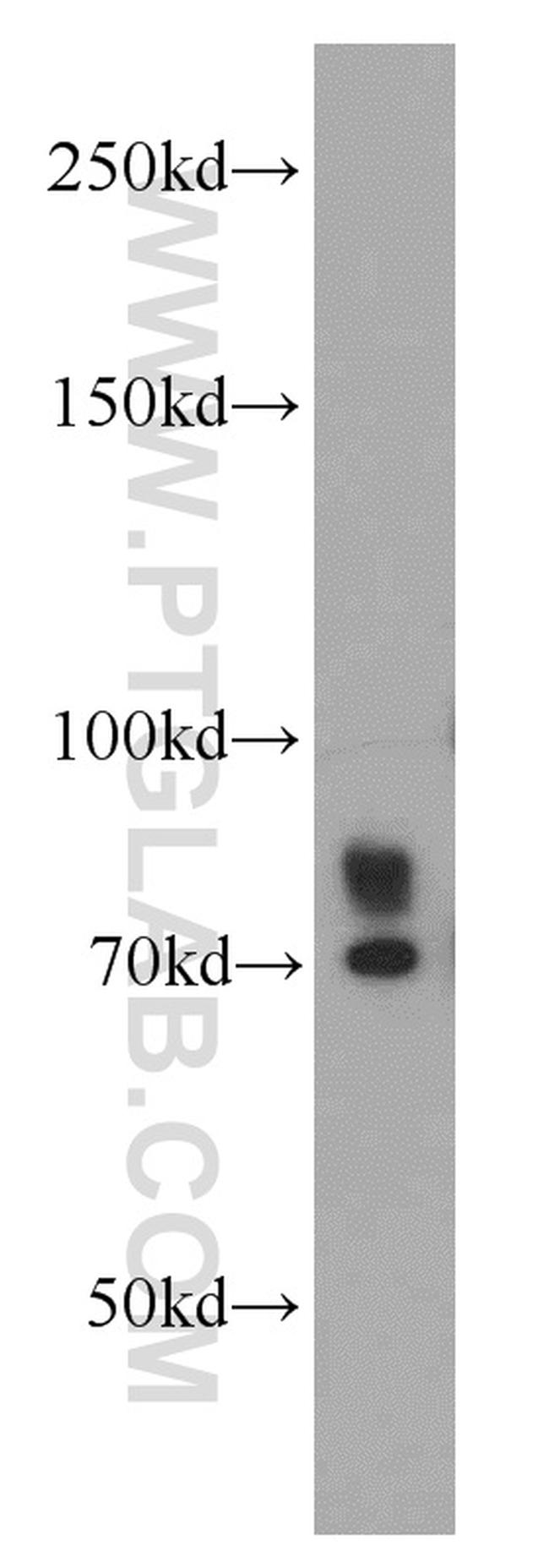 INPP5J Antibody in Western Blot (WB)