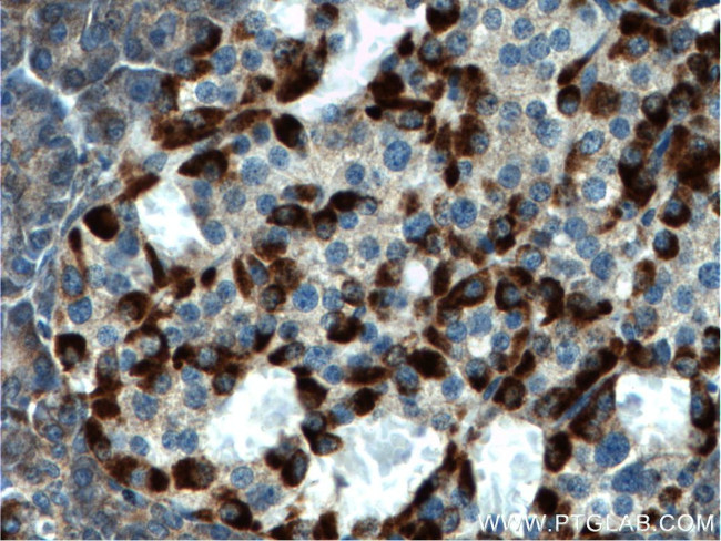 CHIT1 Antibody in Immunohistochemistry (Paraffin) (IHC (P))