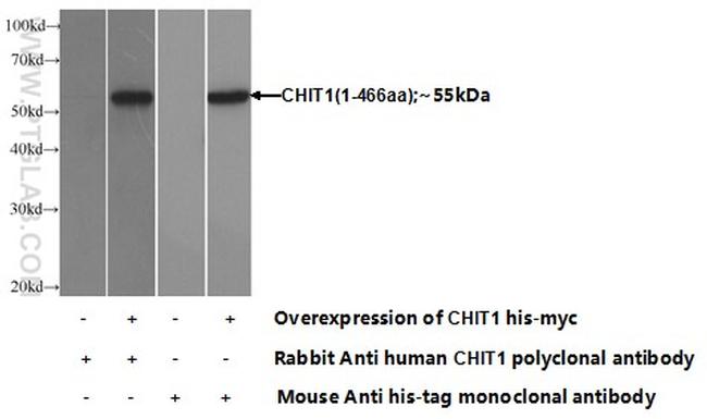 CHIT1 Antibody in Western Blot (WB)