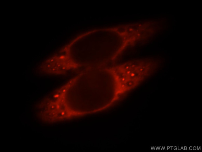 SLC5A8 Antibody in Immunocytochemistry (ICC/IF)