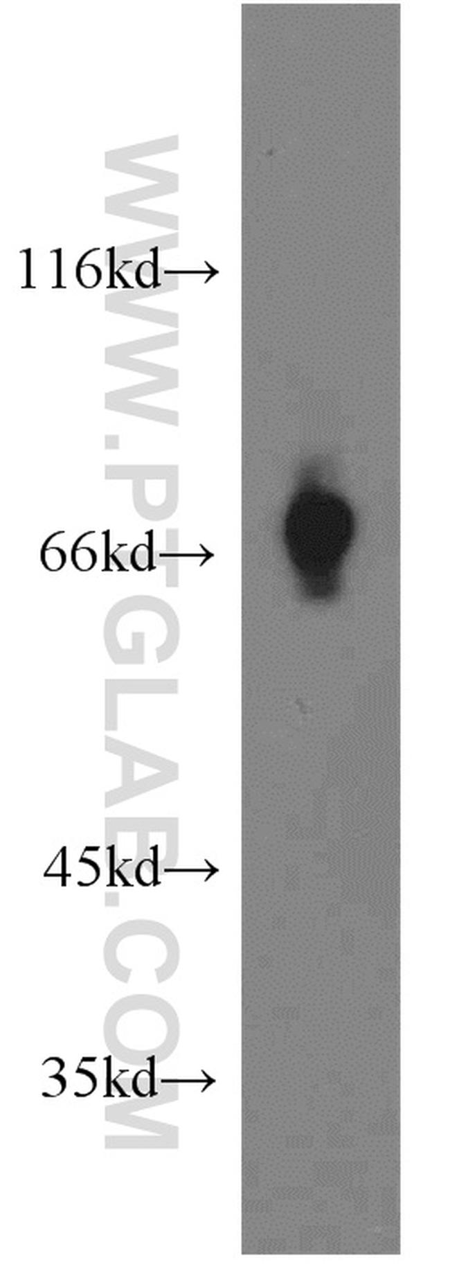 SLC5A8 Antibody in Western Blot (WB)