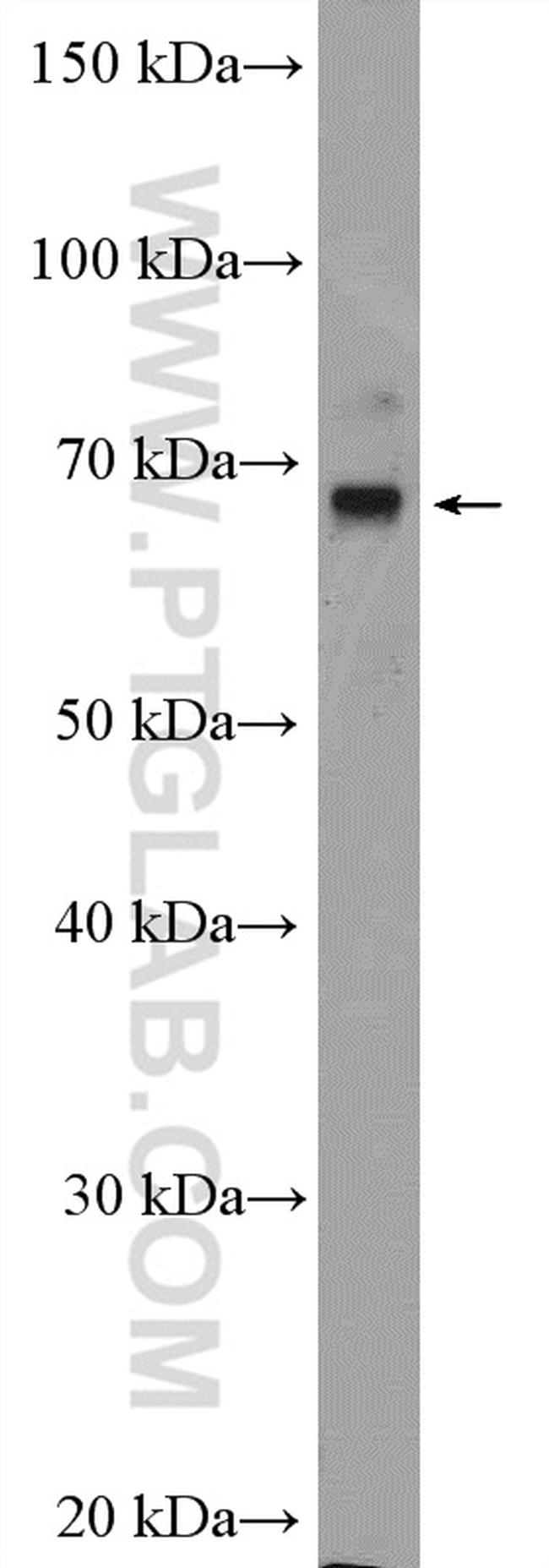 SLC5A8 Antibody in Western Blot (WB)