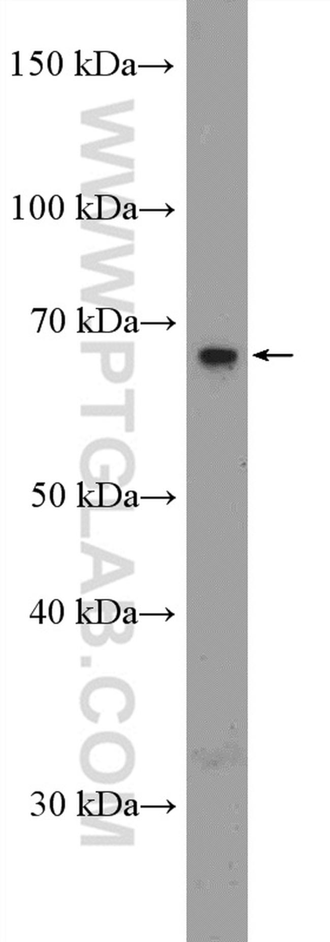 SLC5A8 Antibody in Western Blot (WB)