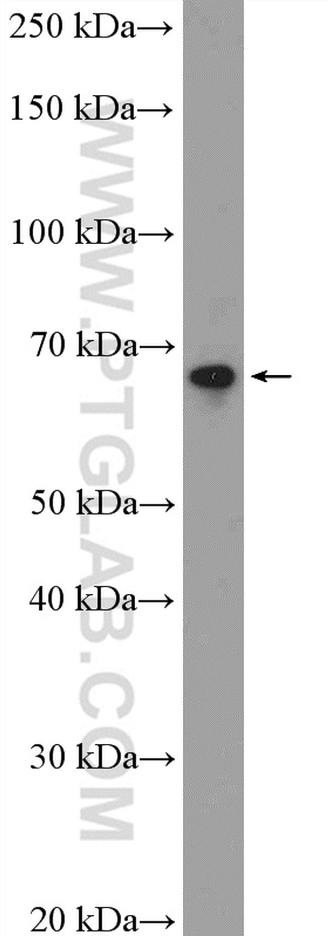 SLC5A8 Antibody in Western Blot (WB)