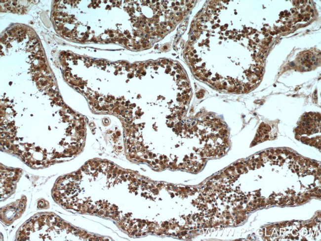 Rubicon Antibody in Immunohistochemistry (Paraffin) (IHC (P))