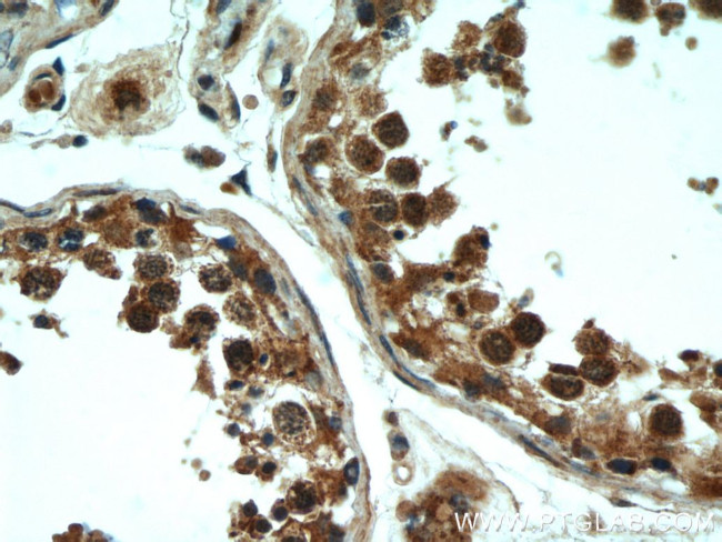 Rubicon Antibody in Immunohistochemistry (Paraffin) (IHC (P))