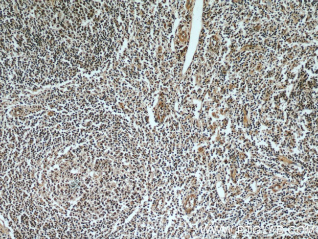 Rubicon Antibody in Immunohistochemistry (Paraffin) (IHC (P))