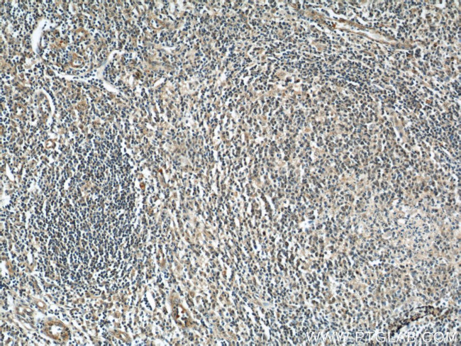 Rubicon Antibody in Immunohistochemistry (Paraffin) (IHC (P))