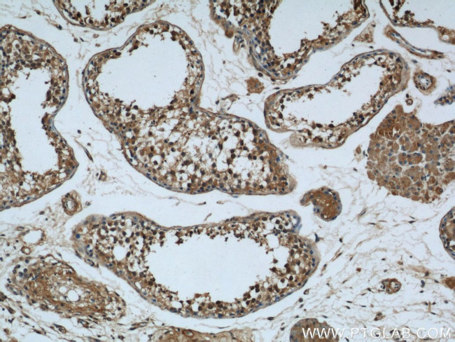 Rubicon Antibody in Immunohistochemistry (Paraffin) (IHC (P))