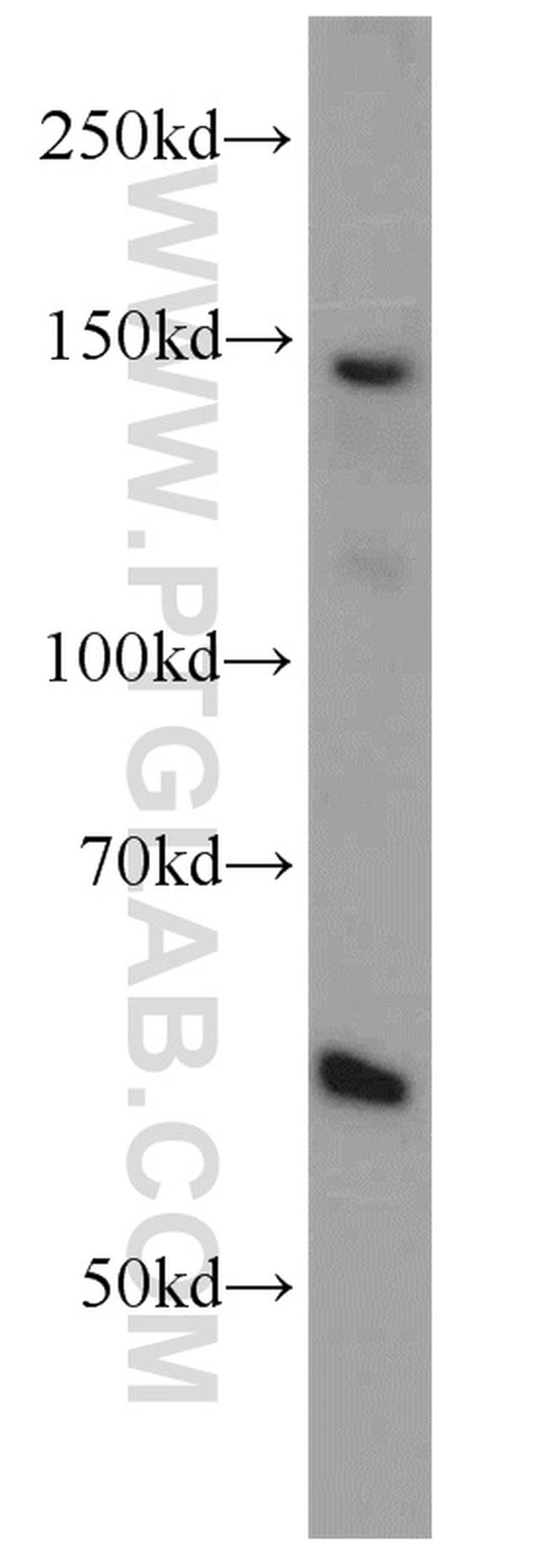 Rubicon Antibody in Western Blot (WB)