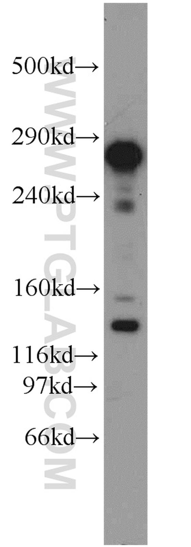 Rubicon Antibody in Western Blot (WB)