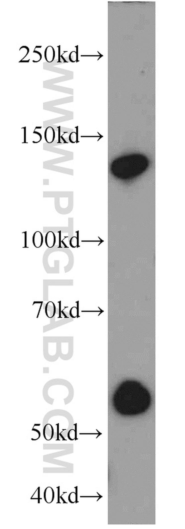 Rubicon Antibody in Western Blot (WB)