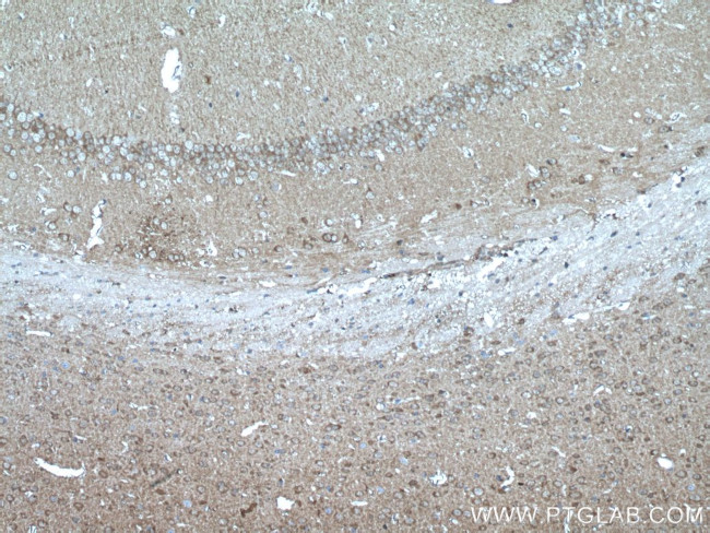 PEA15 Antibody in Immunohistochemistry (Paraffin) (IHC (P))