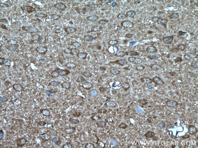 PEA15 Antibody in Immunohistochemistry (Paraffin) (IHC (P))