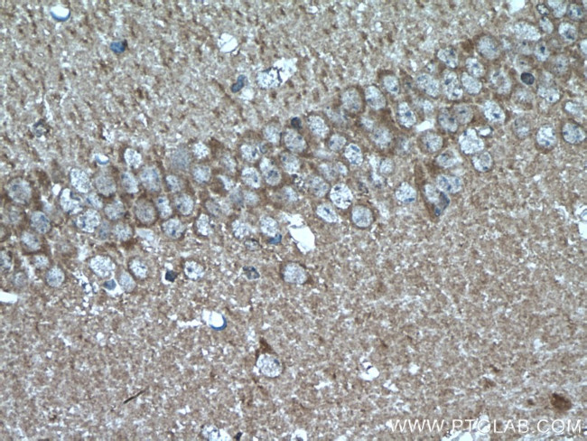 PEA15 Antibody in Immunohistochemistry (Paraffin) (IHC (P))