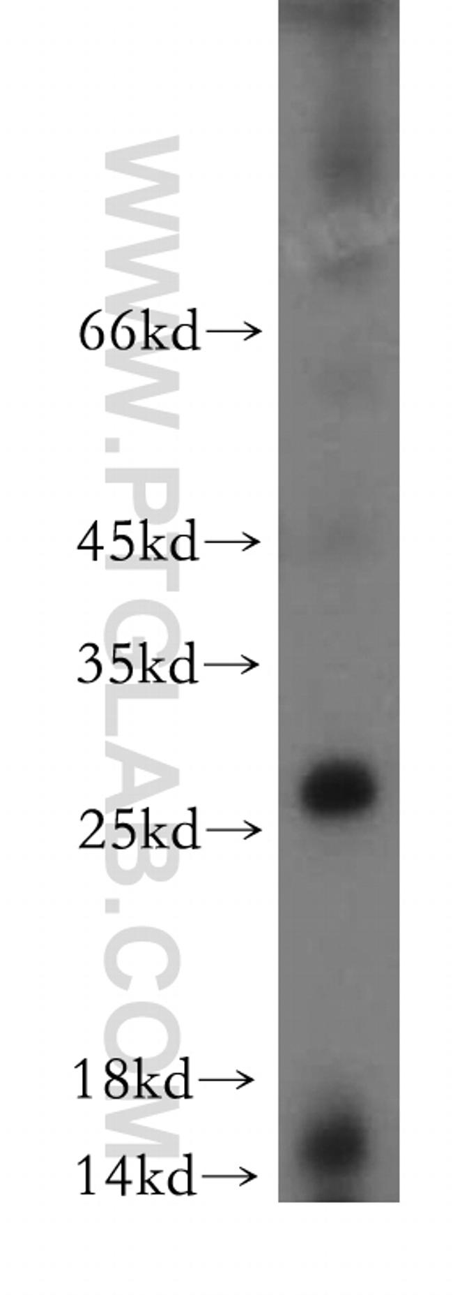 C1orf77 Antibody in Western Blot (WB)