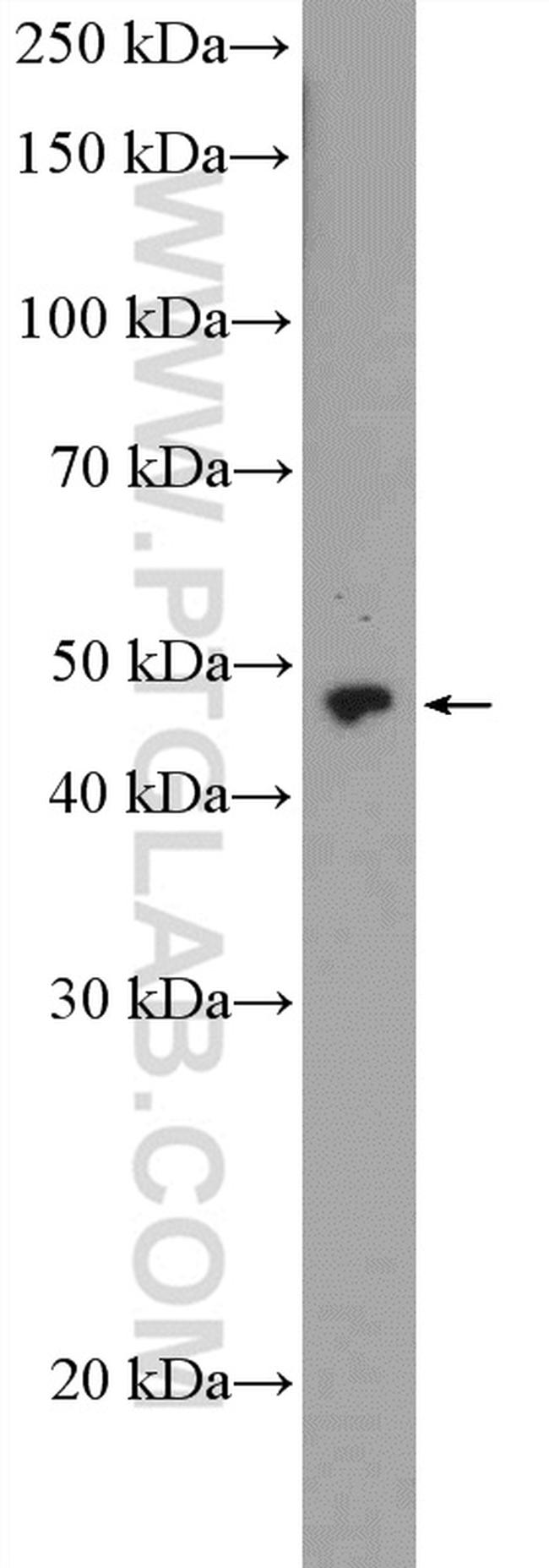 ZNF232 Antibody in Western Blot (WB)